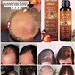 Hoofdhuidserum voor Haarverzorging – productafbeelding