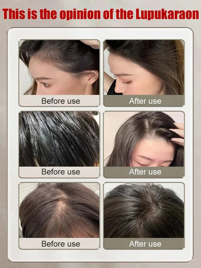 Hoofdhuidserum voor Haarverzorging – productafbeelding