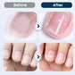 Voedende Nagelherstel Spray voor Droge en Broze Nagels